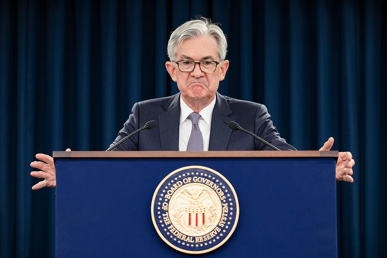 Why might the Federal Reserve cause a recession to fight inflation?  Unanchored expectations.